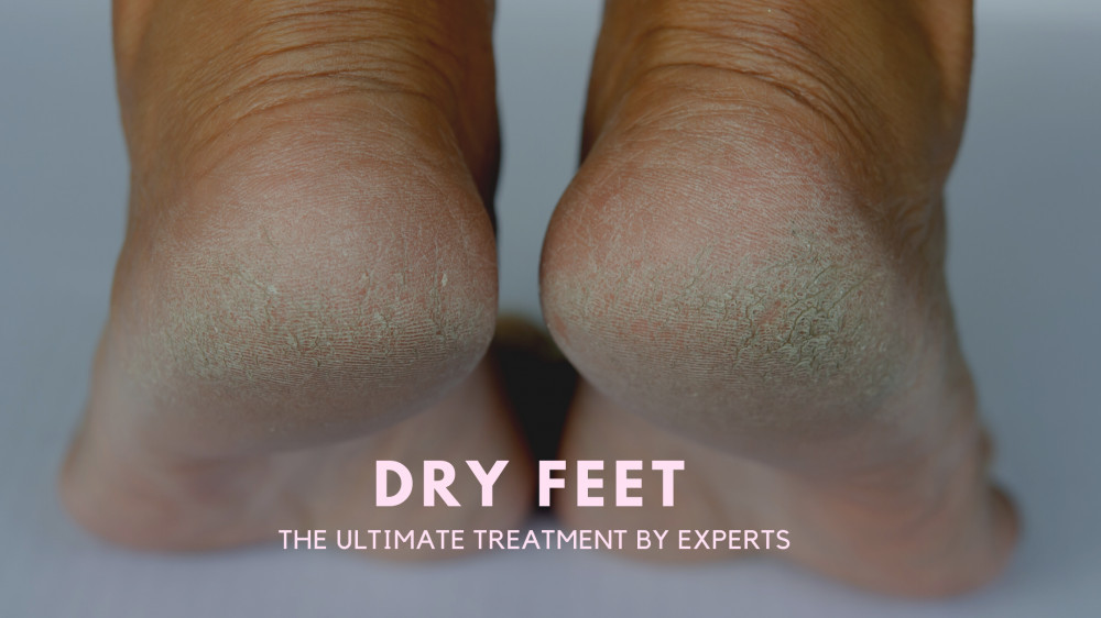 how-to-get-all-dry-skin-off-your-feet-the-ultimate-treatment-by